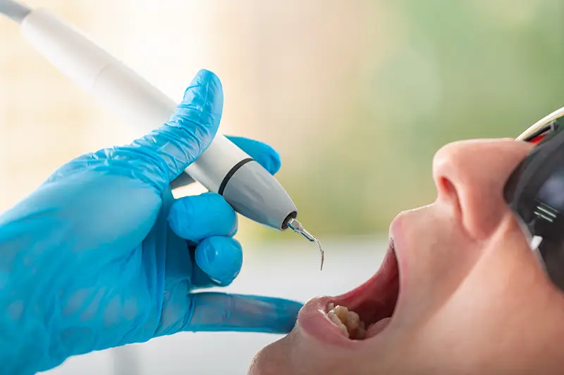 ICD-10 Codes to Report Spring Dental Diseases
