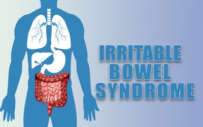 How to Bill and Code IBS, a Gastrointestinal Disorder