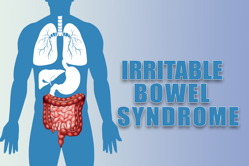 Irritable Bowel Syndrome