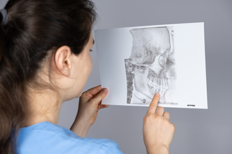 Different Malocclusion Types