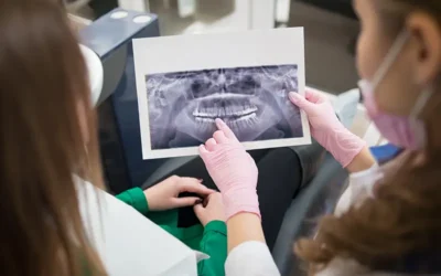 ICD-10 Codes to Report Different Types of Malocclusions