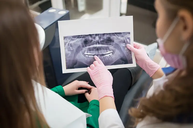 ICD-10 Codes to Report Different Types of Malocclusions