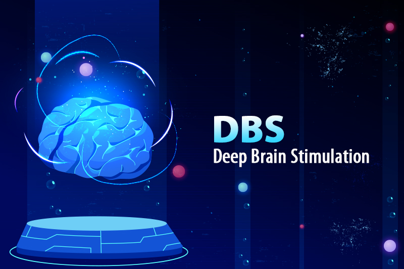 Deep Brain Stimulation DBS