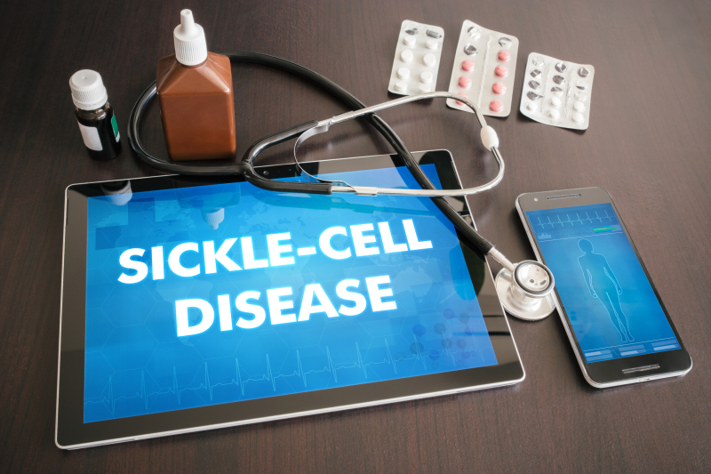 How to Bill and Code for Sickle Cell Disease