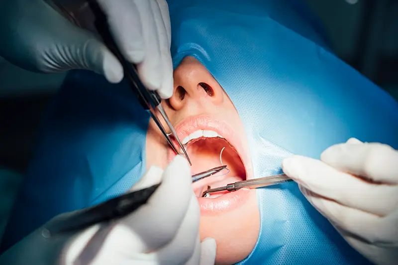 Denied Insurance Claims for Oral Surgery? Uncover Common Reasons