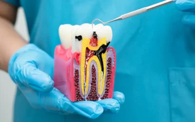Navigating Root Canal Billing: Maximize Reimbursements Minimize Hassles