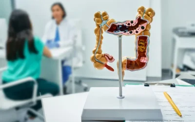 ICD-10 Codes for Diverticulitis – What Medical Coders Need to Know