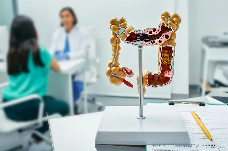 ICD-10 Codes for Diverticulitis – What Medical Coders Need to Know