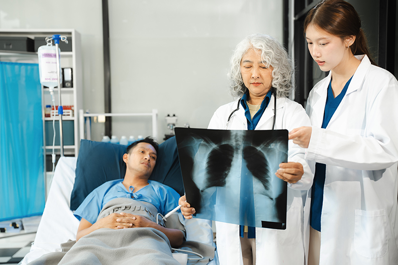 Coding for Community Acquired Pneumonia