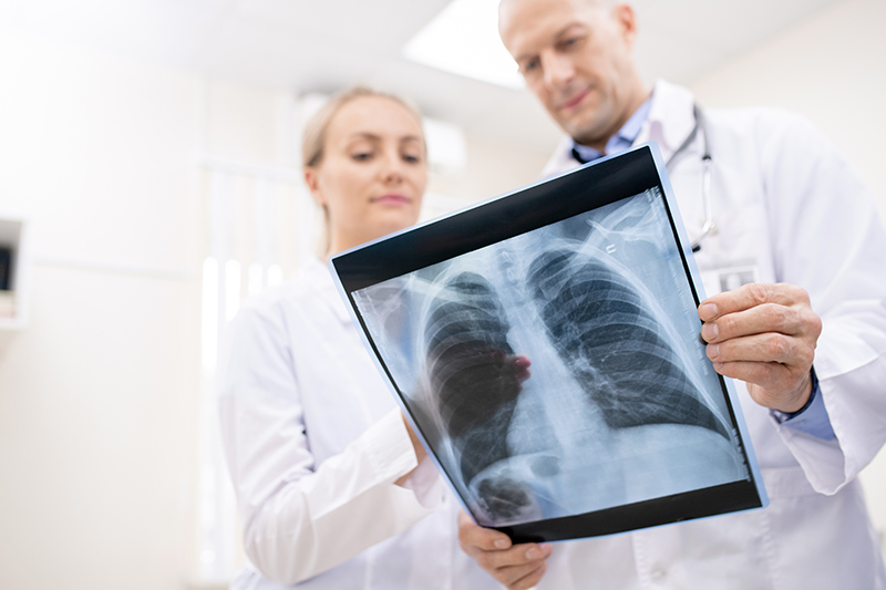 ICD-10 Coding for Atypical Pneumonia Key Guidelines