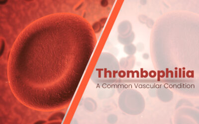 How to Code Thrombophilia – A Common Vascular Condition