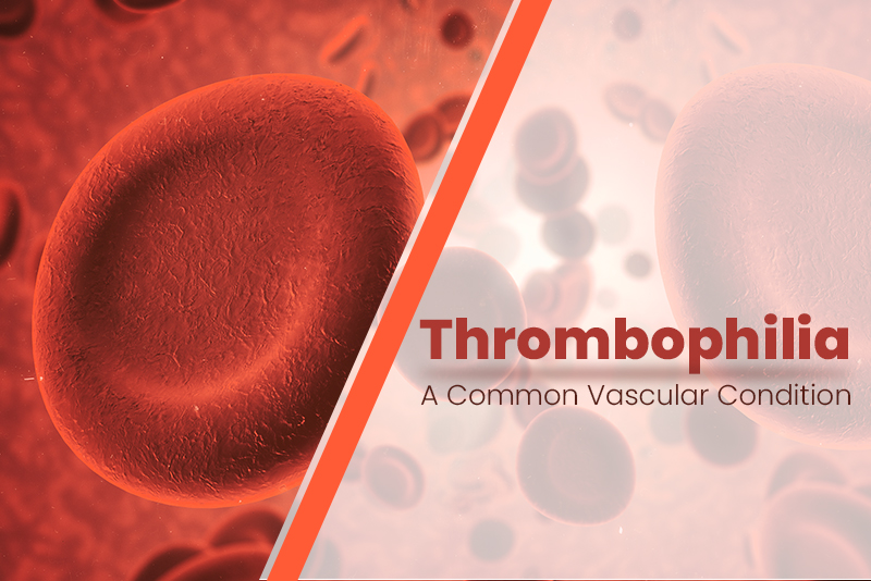How to Code Thrombophilia – A Common Vascular Condition