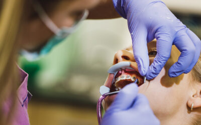 Understanding Revenue Cycle Management in Dentistry
