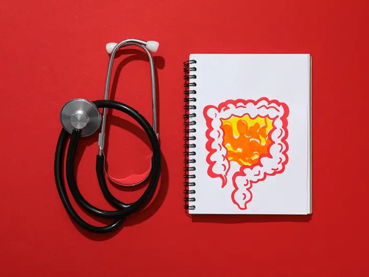 melanotic stool icd 10 What is the ICD-10 (International Classification of Diseases, 10th  Revision) code and procedure code for disimpaction of the rectum?